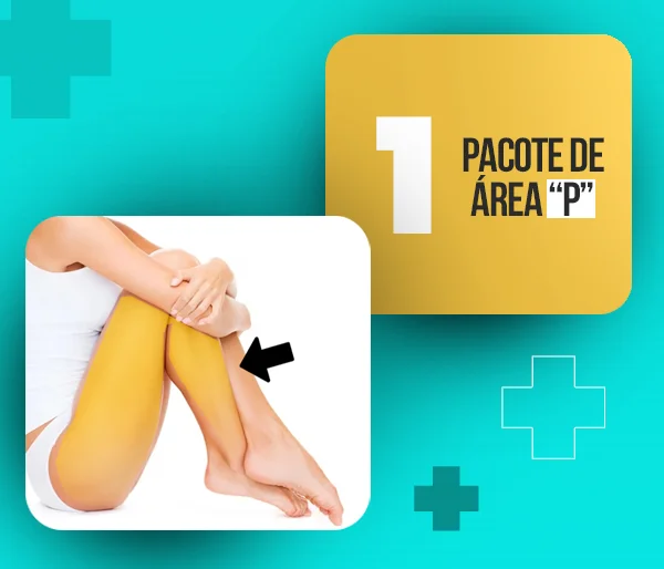 Depilação a laser em Santa Rosa