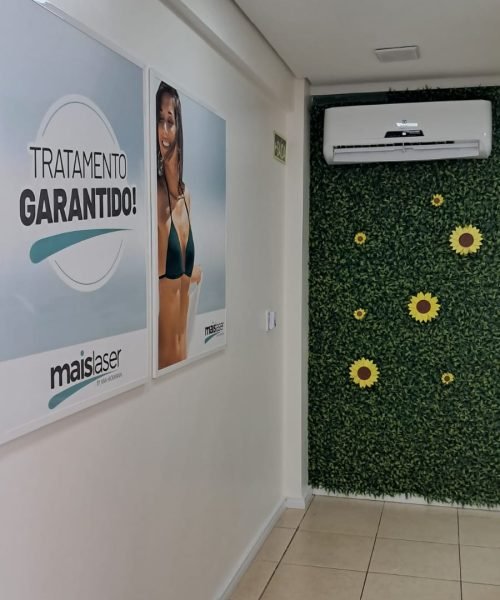 Depilação a laser em Santa Rosa